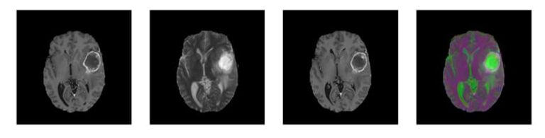 Research in progress: fighting diseases by more easily detecting them